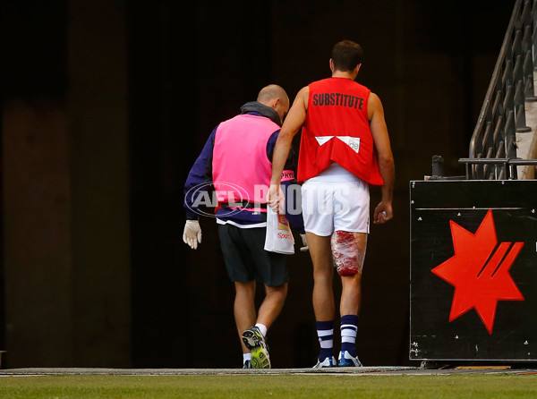 AFL 2014 NAB Challenge - Western Bulldogs v Fremantle - 314966