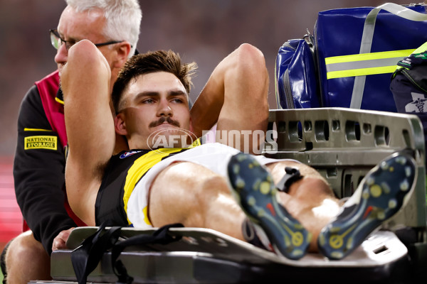 AFL 2024 Round 01 - Carlton v Richmond - A-46480013