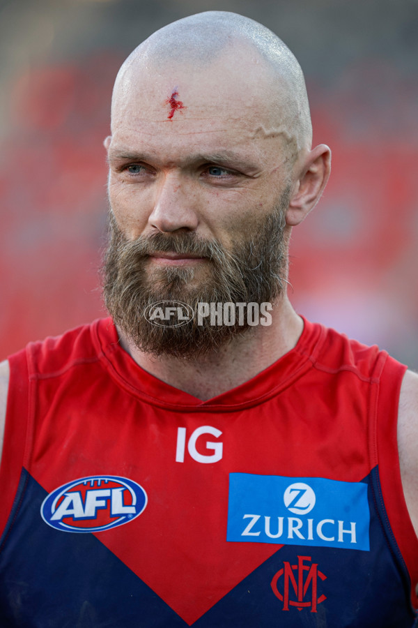 AFL 2024 Round 23 - Gold Coast v Melbourne - A-53078686