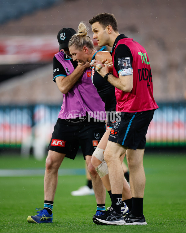 AFLW 2024 Round 02 - Western Bulldogs v Port Adelaide - A-53712635