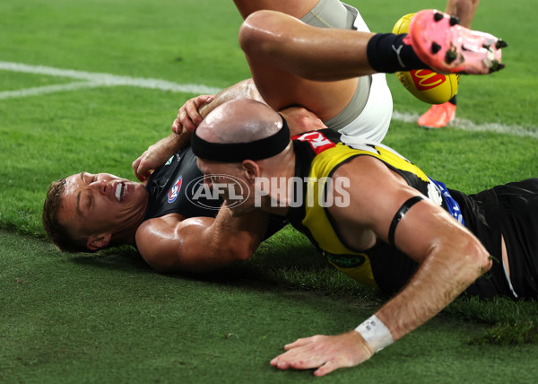 AFL 2025 Round 01 - Richmond v Carlton - A-57761880
