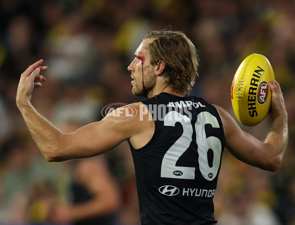 AFL 2025 Round 01 - Richmond v Carlton - A-57763202