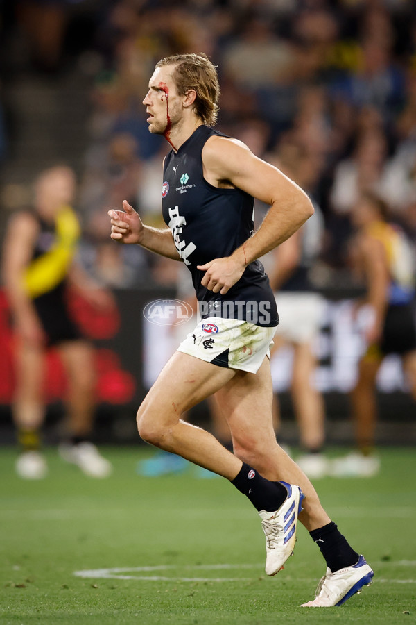 AFL 2025 Round 01 - Richmond v Carlton - A-57765826