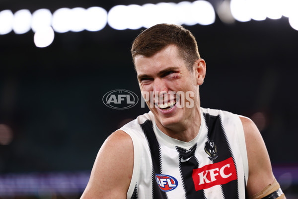 AFL 2025 Round 02 - Footscray v Collingwood - A-57991901