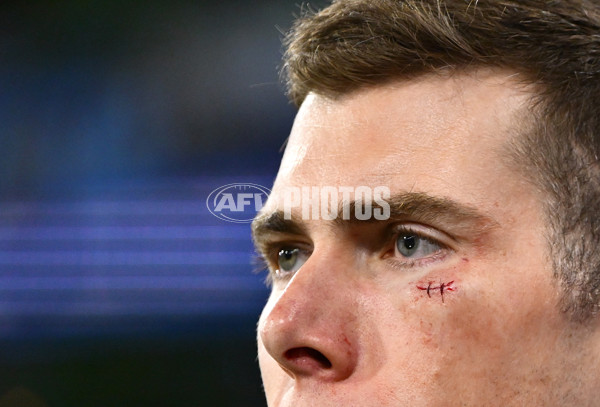 AFL 2025 Round 02 - Footscray v Collingwood - A-57991958