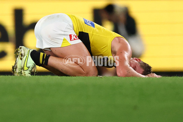 AFL 2025 Round 03 - St Kilda v Richmond - A-58193833