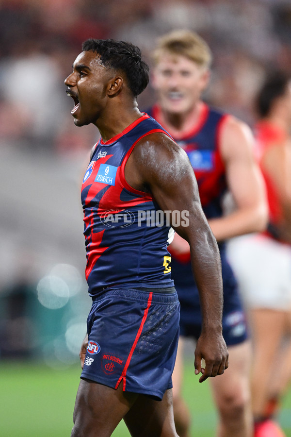AFL 2025 Round 05 - Melbourne v Essendon - A-58555823