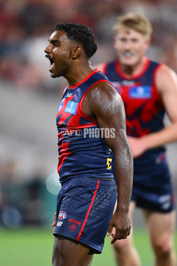 AFL 2025 Round 05 - Melbourne v Essendon - A-58555824