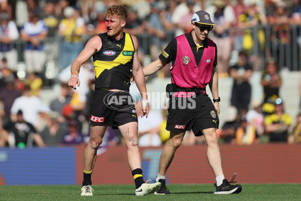 AFL 2025 Round 05 - Richmond v Fremantle - A-58572238