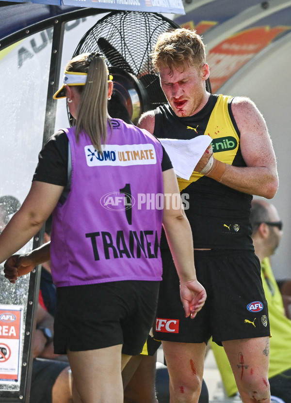 AFL 2025 Round 05 - Richmond v Fremantle - A-58577782