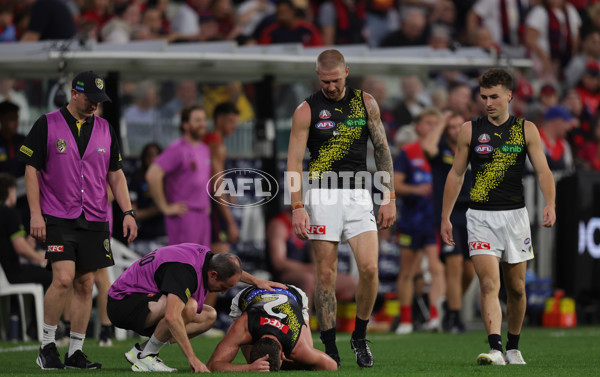 AFL 2025 Round 07 - Melbourne v Richmond - A-58932232