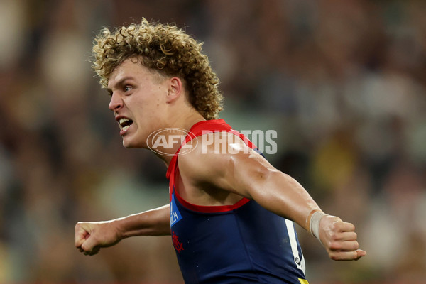 AFL 2025 Round 07 - Melbourne v Richmond - A-58933083