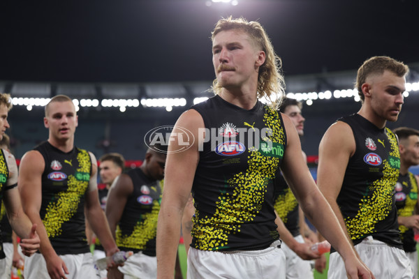 AFL 2025 Round 07 - Melbourne v Richmond - A-58937102