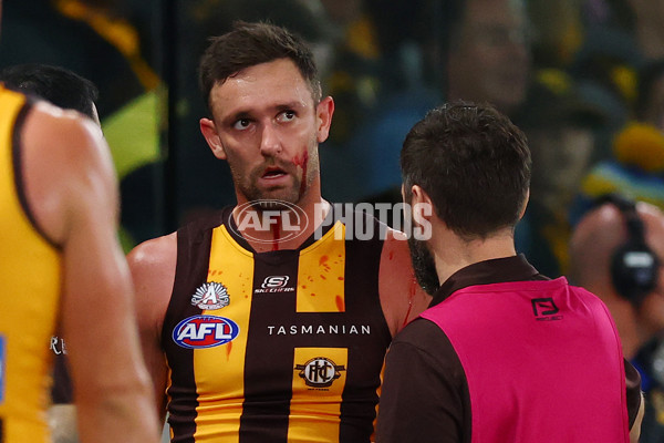 AFL 2025 Round 07 - Hawthorn v West Coast - A-59028739