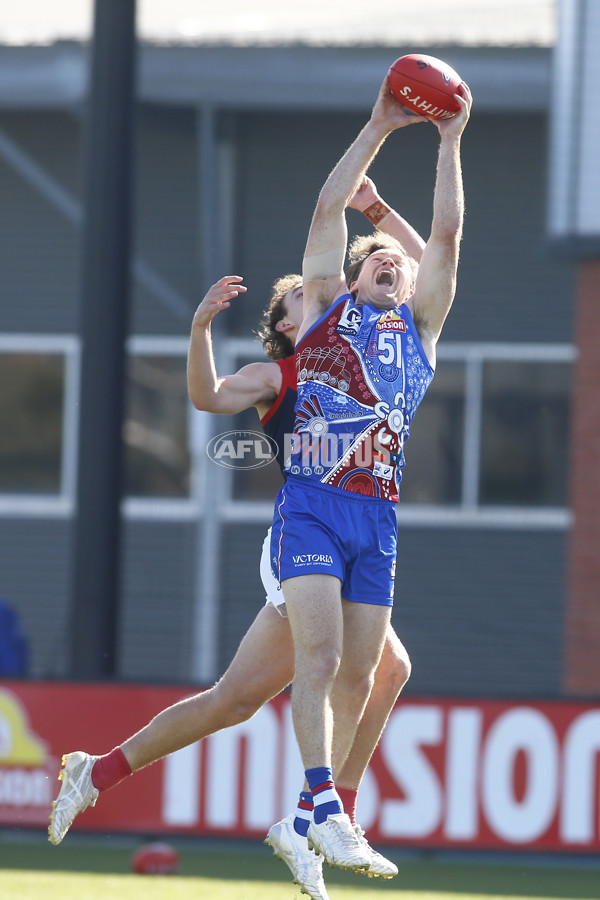 VFL 2025 Round 07 - Footscray Bulldogs v Casey Demons - A-59394086
