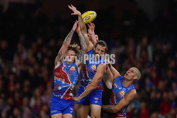 AFL 2025 Round 10 - Western Bulldogs v Essendon - A-59526838
