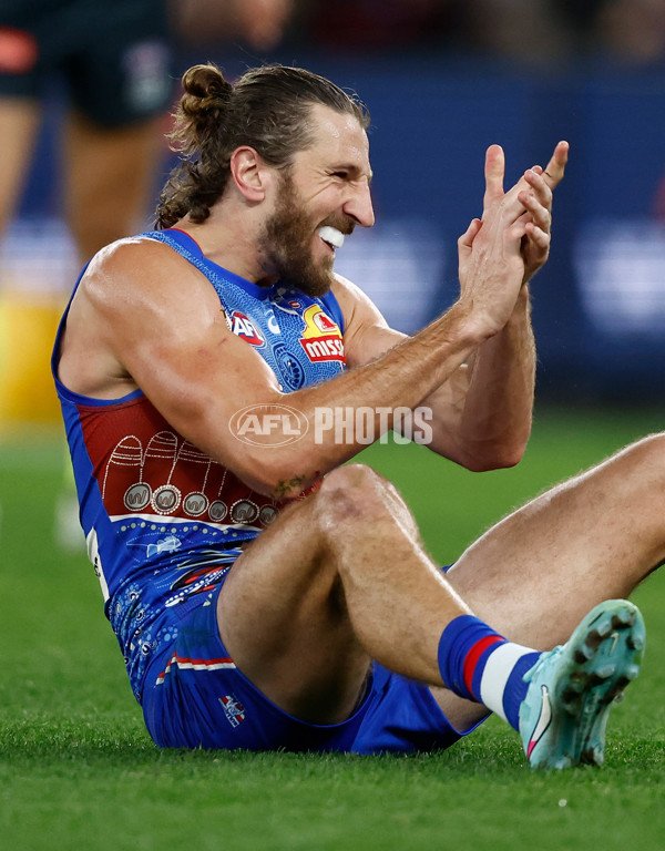 AFL 2025 Round 10 - Western Bulldogs v Essendon - A-59529557