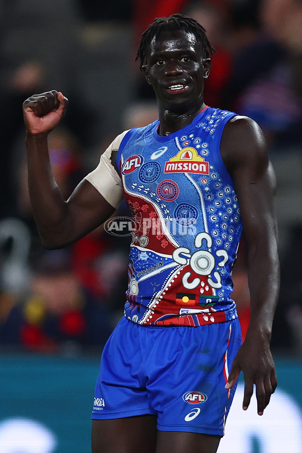 AFL 2025 Round 10 - Western Bulldogs v Essendon - A-59534885