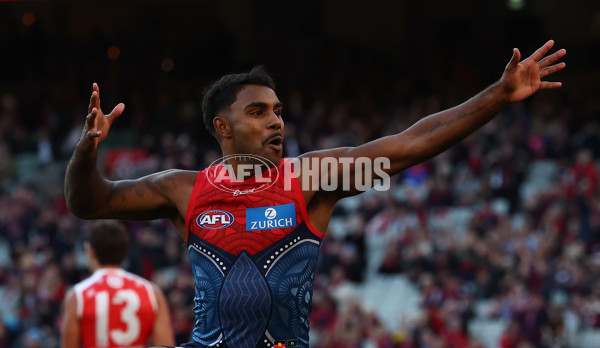AFL 2025 Round 11 - Narrm v Sydney - A-59696003