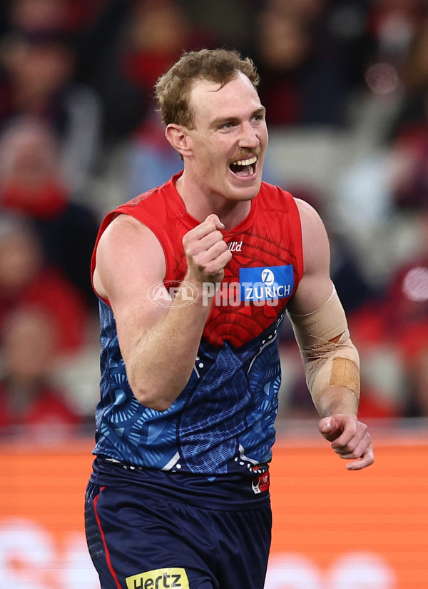 AFL 2025 Round 11 - Narrm v Sydney - A-59701485