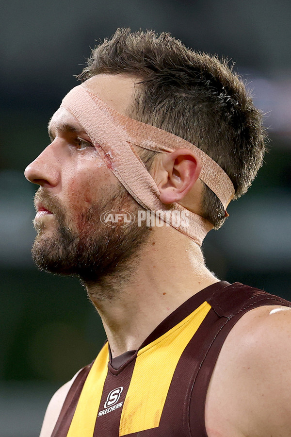 AFL 2025 Round 12 - Collingwood v Hawthorn - A-59745638