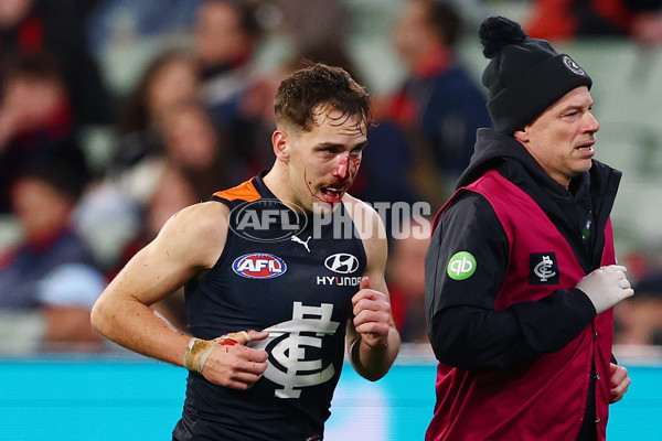 AFL 2025 Round 19 - Carlton v Melbourne - A-60638576