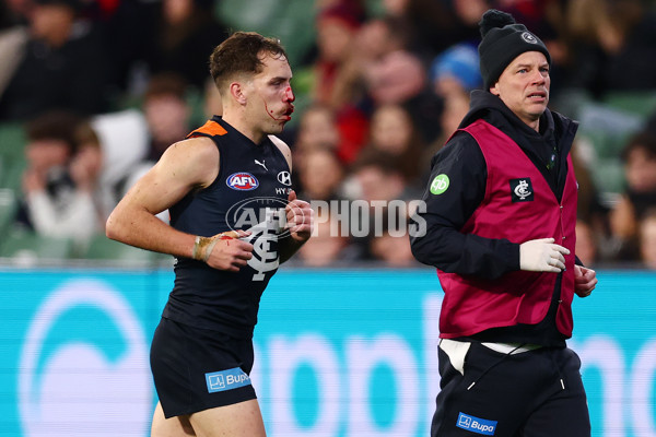 AFL 2025 Round 19 - Carlton v Melbourne - A-60638577