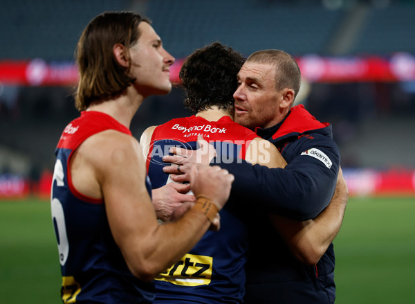 AFL 2025 Round 21 - Melbourne v West Coast - A-60999630