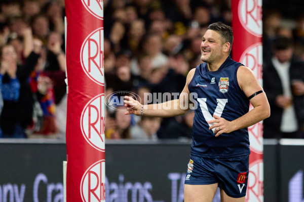 AFL 2025 Media - AFL Legends Match - A-61863644