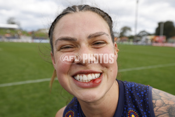 AFLW 2025 Round 03 - GWS v Kuwarna - A-62096232