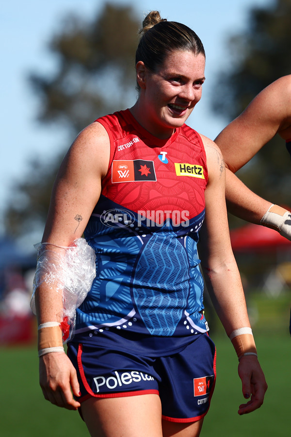 AFLW 2025 Round 04 - Narrm v Richmond - A-62265133
